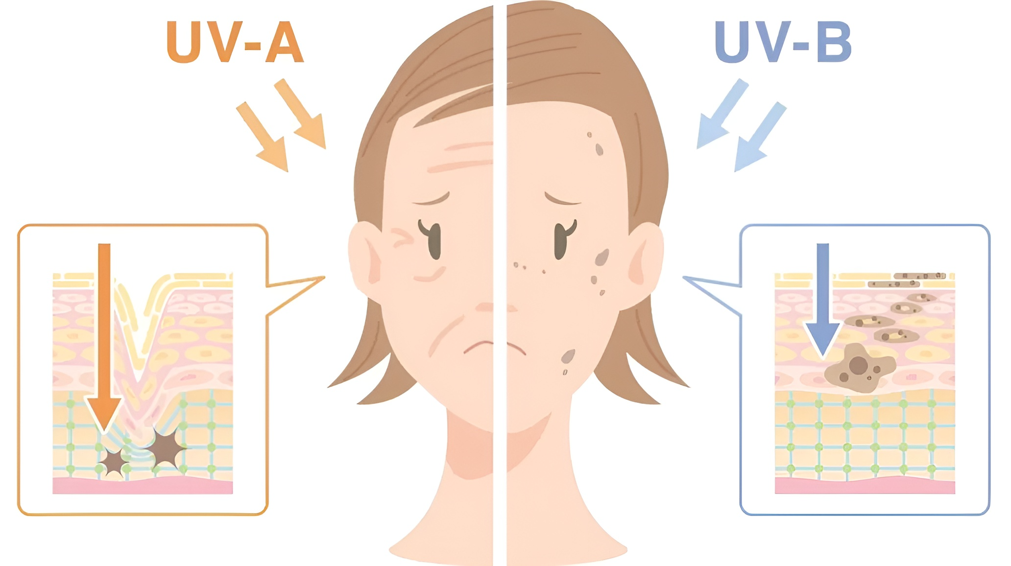 Ảnh minh họa ảnh hưởng của tia UVA và UVB lên làn da